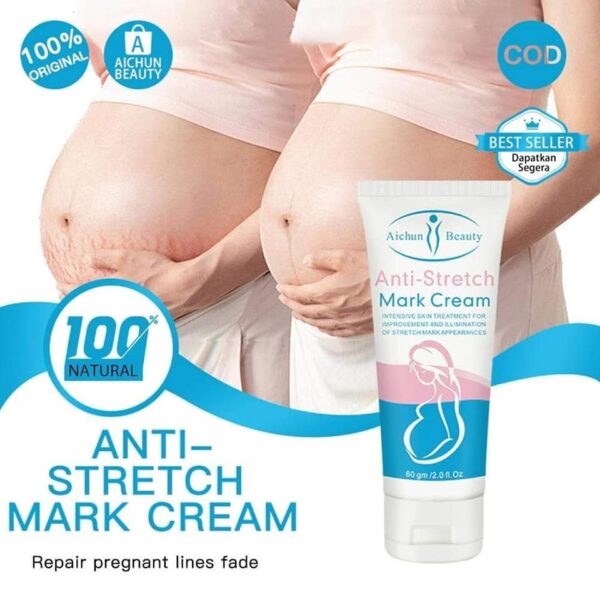 anti stretch mark cream